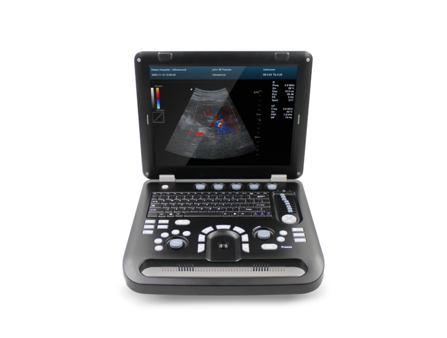 CMS1700C Color Doppler Ultrasound Diagnostic System