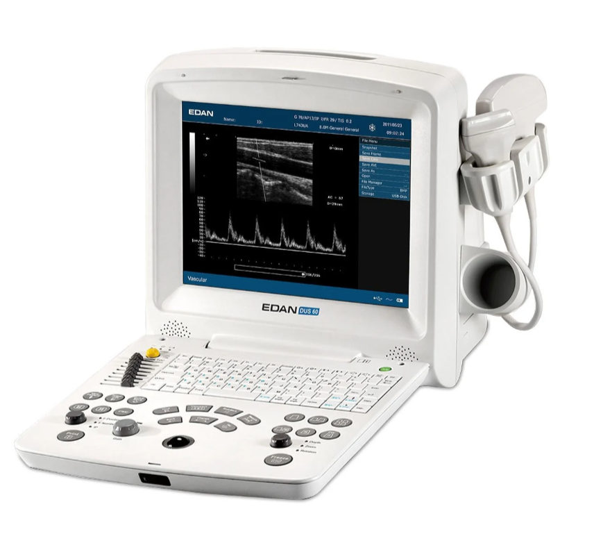 Edan DUS 60 Digital Ultrasound