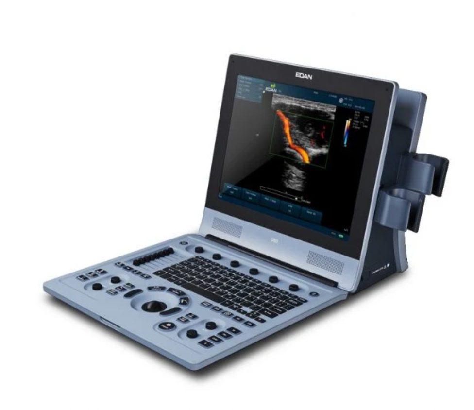 Edan U60 Diagnostic Ultrasound System